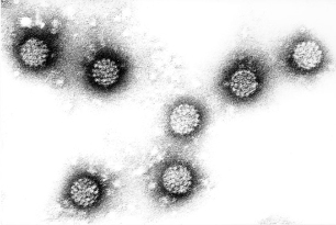 انسانی پیپیلوما وائرس
